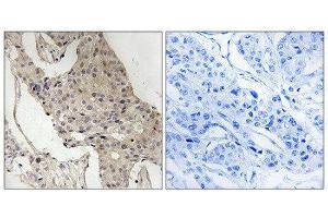 Immunohistochemistry (IHC) image for anti-GRB2-Associated Binding Protein 2 (GAB2) (pSer623) antibody (ABIN1847780) (GAB2 antibody  (pSer623))