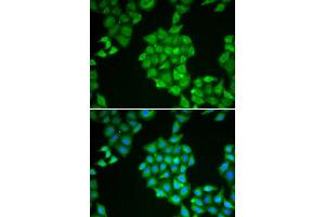 Immunofluorescence analysis of HeLa cell using EPPIN antibody. (Eppin antibody)