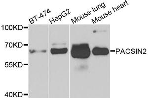 Western blot analysis of extracts of various cell lines, using PACSIN2 antibody. (PACSIN2 antibody)