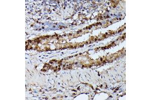 Immunohistochemistry of paraffin-embedded rat lung using GA antibody (ABIN6130412, ABIN6140923, ABIN6140926 and ABIN6215461) at dilution of 1:100 (40x lens). (GADD45A antibody  (AA 1-165))
