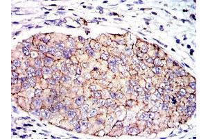 Immunohistochemistry (IHC) image for anti-Plasminogen Activator Inhibitor 1 (SERPINE1) antibody (ABIN969566)