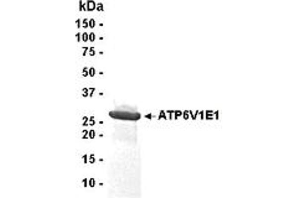 ATP6V1E1 Protein (AA 1-226)