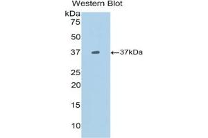 Detection of Recombinant BLC1, Mouse using Polyclonal Antibody to B-Lymphocyte Chemoattractant (BLC) (CXCL13 antibody  (AA 22-109))