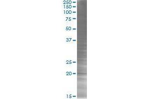 COMMD3 transfected lysate. (COMMD3 293T Cell Transient Overexpression Lysate(Denatured))