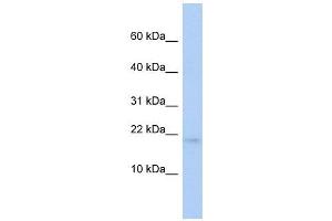 RFESD antibody used at 1 ug/ml to detect target protein. (RFESD antibody)