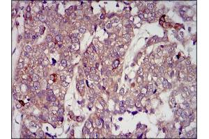 Immunohistochemistry (IHC) image for anti-Insulin-Like Growth Factor 2 (IGF2) (AA 25-180) antibody (ABIN1098108)