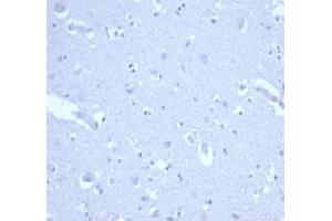 Immunohistochemistry (IHC) image for anti-Cyclin-Dependent Kinase Inhibitor 1A (p21, Cip1) (CDKN1A) (AA 1-100) antibody (ABIN7504137)