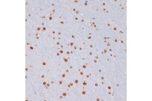 Immunohistochemistry (IHC) image for anti-Histone 3 (H3) (H3K27me) antibody (ABIN3023269)