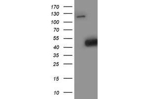 HEK293T cells were transfected with the pCMV6-ENTRY control (Left lane) or pCMV6-ENTRY SMS (Right lane) cDNA for 48 hrs and lysed. (SMS antibody)