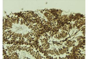 ABIN6273696 at 1/100 staining Mouse testis tissue by IHC-P. (SETDB2 antibody  (N-Term))