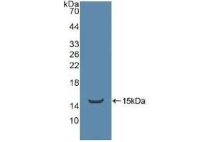 Detection of Recombinant ADRbK1, Human using Polyclonal Antibody to TEK Tyrosine Kinase, Endothelial (Tie2) (TEK antibody  (AA 1-116))