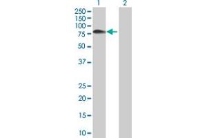 Western Blotting (WB) image for UMOD 293T Cell Transient Overexpression Lysate(Denatured) (ABIN1333854)