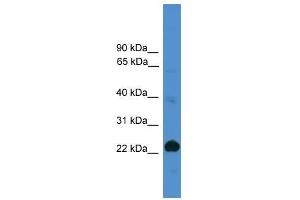 CD8A antibody used at 0. (CD8 alpha antibody  (Middle Region))