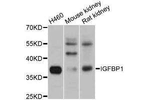 Western blot analysis of extracts of various cell lines, using IGFBP1 antibody (ABIN5971533) at 1/1000 dilution. (IGFBPI antibody)