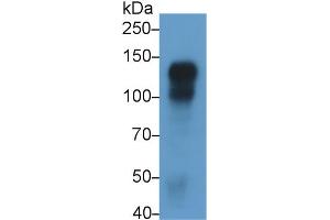 Detection of CDH5 in Rat Placenta lysate using Monoclonal Antibody to Cadherin 5 (CDH5) (Cadherin 5 antibody  (AA 59-382))