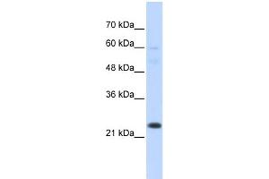 WB Suggested Anti-TAF12 Antibody Titration:  0. (TAF12 antibody  (N-Term))
