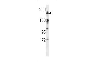 Western blot analysis in human normal Uterus tissue lysates (35ug/lane). (MAP3K4 antibody  (AA 1067-1097))