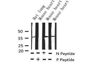 Western blot analysis of Phospho-EFNB1/2 (Tyr330) expression in various lysates (Ephrin B2 antibody  (pTyr330))