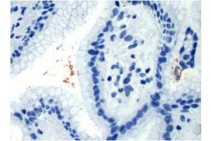 Image no. 1 for anti-Helicobacter Pylori (H. pylori) antibody (ABIN952704) (Helicobacter Pylori antibody)