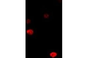 Immunofluorescent analysis of DCK staining in MCF7 cells. (DCK antibody)