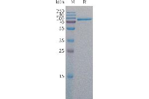 Human MELTF Protein, His Tag on SDS-PAGE under reducing condition. (MFI2 Protein (AA 20-708) (His tag))