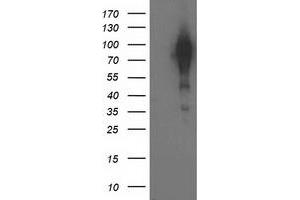 Western Blotting (WB) image for anti-Breast Cancer Anti-Estrogen Resistance 1 (BCAR1) antibody (ABIN1496833) (BCAR1 antibody)