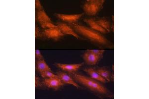 Immunofluorescence analysis of H9C2 cells using [KO Validated] HINT1 Rabbit pAb  at dilution of 1:100 (40x lens). (HINT1 antibody  (AA 1-126))