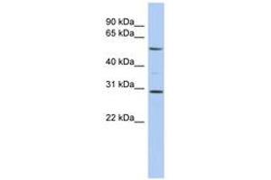 Image no. 1 for anti-V-Rel Reticuloendotheliosis Viral Oncogene Homolog B (RELB) (AA 395-444) antibody (ABIN6744395) (RELB antibody  (AA 395-444))