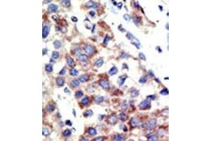 Image no. 2 for anti-Histone 3 (H3) (H3K9me2) antibody (ABIN356586) (Histone 3 antibody  (H3K9me2))