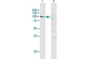 Lane 1: CCNT1 transfected lysate ( 80. (CCNT1 293T Cell Transient Overexpression Lysate(Denatured))