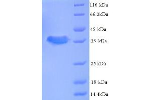 SDS-PAGE (SDS) image for Cerebral Palsy, Ataxic 1 (CPAT1) (AA 1-77), (full length) protein (GST tag) (ABIN5713694) (CPAT1 Protein (AA 1-77, full length) (GST tag))