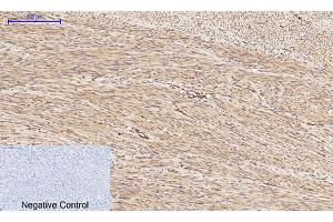 Immunohistochemical analysis of paraffin-embedded human uterus tissue. (PI3K p85/p55 antibody  (pTyr199, pTyr467))