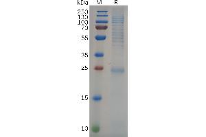 Human KRAS Protein, His Tag on SDS-PAGE under reducing condition. (K-RAS Protein (AA 2-185) (His tag))