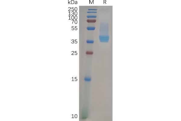 CXCR4 Protein (AA 1-38) (Fc Tag)