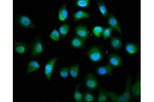 Immunofluorescence staining of A549 cells with ABIN7157607 at 1:100, counter-stained with DAPI. (KIF18A antibody  (AA 176-279))