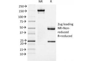 SDS-PAGE Analysis of Purified, BSA-Free FOXA1 Antibody (clone FOXA1/1519). (FOXA1 antibody  (AA 372-472))