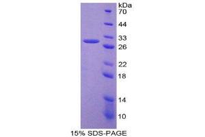 SDS-PAGE (SDS) image for GATA Binding Protein 4 (GATA4) (AA 201-442) protein (His tag) (ABIN1980726) (GATA4 Protein (AA 201-442) (His tag))