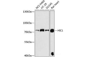 Western blot analysis of extracts of various cell lines using HIC1 Polyclonal Antibody at dilution of 1:3000. (HIC1 antibody)