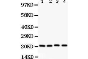 Western Blotting (WB) image for anti-Caveolin 1, Caveolae Protein, 22kDa (CAV1) (AA 4-178) antibody (ABIN3043803) (Caveolin-1 antibody  (AA 4-178))