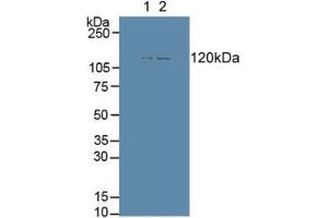 Figure. (ENPEP antibody  (AA 409-624))