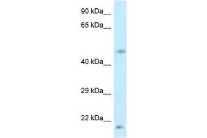 WB Suggested Anti-LOC100360413 Antibody   Titration: 1. (LOC100360413 antibody  (Middle Region))