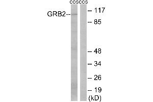 Immunohistochemistry analysis of paraffin-embedded human colon carcinoma tissue using GRB2 (Ab-159) antibody. (GAB2 antibody  (Ser159))