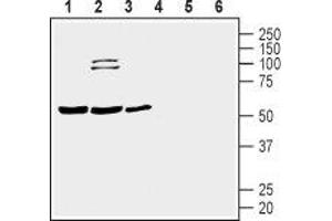 Western blot analysis of human Jurkat T-cell leukemia cell (lanes 1 and 4), human THP-1 monocytic leukemia cell (lanes 2 and 5) and human MEG-01 megakaryoblastic leukemia cell (lanes 3 and 6) lysates: - 1-3. (Prostacyclin Receptor antibody  (3rd Extracellular Loop))