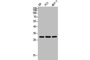Western Blot analysis of KB PC-3 MCF7 cells using ApoF Polyclonal Antibody (Apolipoprotein F antibody  (C-Term))