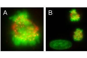 Image no. 1 for anti-Centromere Protein E, 312kDa (CENPE) antibody (ABIN290167) (CENPE antibody)