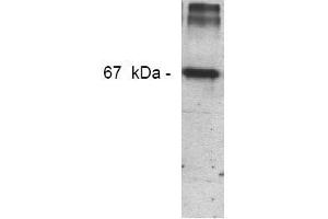 Western Blotting (WB) image for anti-Nitrotyrosine antibody (ABIN126845) (Nitrotyrosine antibody)