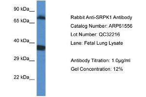 Western Blotting (WB) image for anti-SRSF Protein Kinase 1 (SRPK1) (C-Term) antibody (ABIN786443) (SRPK1 antibody  (C-Term))