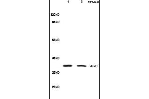 Formalin-fixed and paraffin embedded rat colitis tissue labeled with Anti-IL-1 Beta/IL-1B Polyclonal Antibody, Unconjugated (ABIN872644) at 1:200, followed by conjugation to the secondary antibody and DAB staining (IL-1 beta antibody  (AA 161-269))