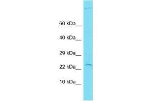 Host: Rabbit Target Name: CENPBD1 Sample Type: Hela Whole Cell lysates Antibody Dilution: 1. (CENPBD1 antibody  (N-Term))