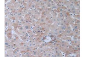 IHC-P analysis of Human Liver Tissue, with DAB staining. (GLA antibody  (AA 81-429))